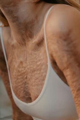 Povestea mea de mai bine: cum am acceptat că nu ești perfect